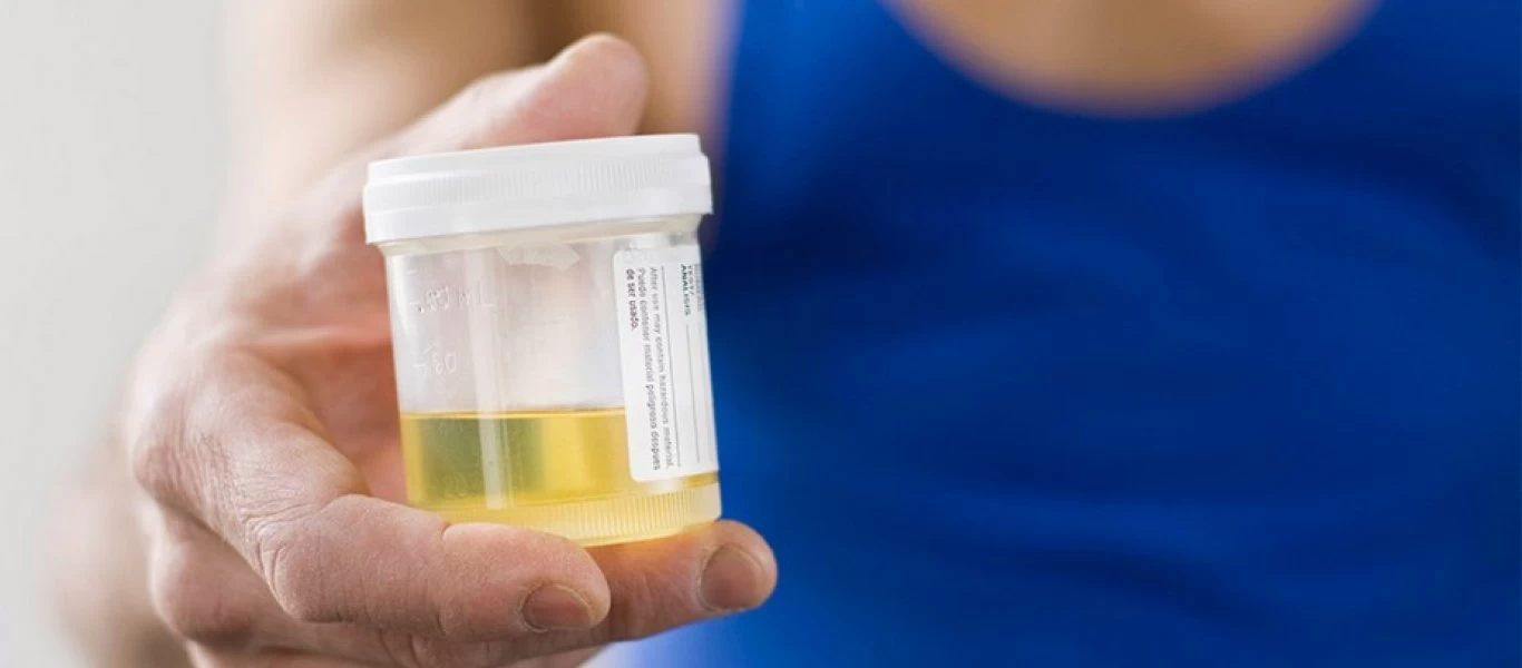 Θολά ούρα: Τι σημαίνει - Τι πρέπει να γνωρίζετε